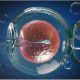 Top 7 Best IVF Centres in Kolkata With High Success Rates | Aurawomen.in